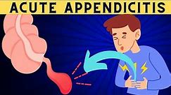 Acute Appendicitis Signs And Symptoms, Risk Factors, Diagnosis And Treatment