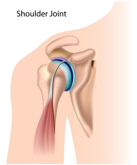 The components of the ball and cup are reversed on the right—a reverse shoulder replacement. Shoulder joint. Diagram of the shoulder joint, eps8, gradient and mesh printing #Sponsored , # ...