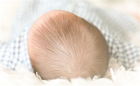 赤ちゃんの頭が変形しているけど大丈夫!？タイプ別変形の ...