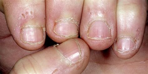Crisis de angustia al separarse de los cuidadores. 22 fotos que les harán dejar de morderse las uñas para ...