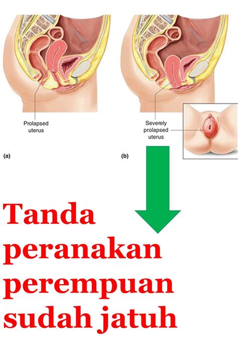 Tips dan cara naikkan peranakan sendiri. Info Penting !! 6 Tanda Utama Peranakan Wanita Telah Jatuh ...