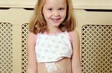 tube feeding girl young gastric science library photograph abdomen 16th uploaded september which