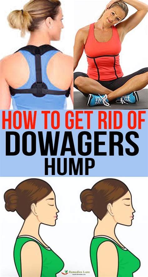 After a long, exhausting desert journey the same camel will have a hump that is floppy and bent over to one side. How to Get Rid of Dowagers Hump | Body exercise helpful ...