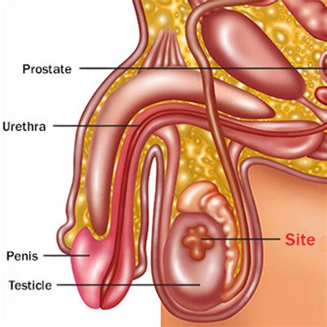 Certain types of testicular cancer are more likely to spread than others. Cancer: Guide to Testicular Cancer