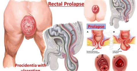 Maybe you would like to learn more about one of these? بعد أن نجا من الشذوذ الجنسي ... بالكاد