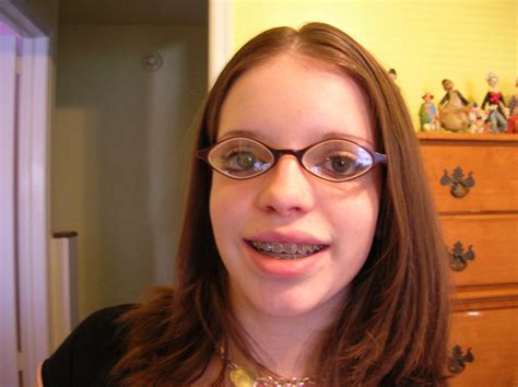 Maybe you would like to learn more about one of these? Photo: plussie with braces | GwG-Plus album | Micha ...