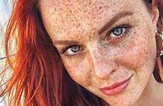 freckles redheads face freckle