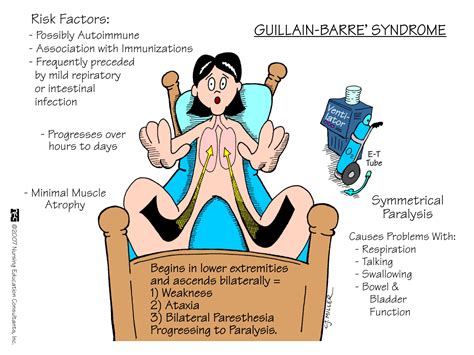 Guillain barre syndrome can occur after a respiratory or gastrointestinal viral infection. Guillain-Barre Syndrome - ONESTOPNURSING