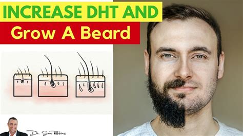 Dht hair loss in men is of male pattern baldness and causes hair loss or hair thinning along the hairline, temple and crown region. 💂‍♂️ How To Increase DHT For Muscle & Beard Growth - by Dr ...