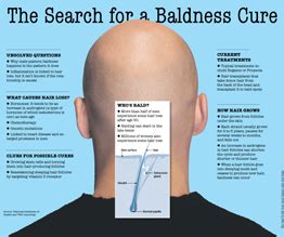 The Search for a Baldness Cure - WSJ