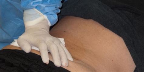 These tumors can be primary tumors (within the bone) or secondary tumors (spread to an adjacent site) like multiple myeloma of the bone marrow or metastasize from a distant site, such as transitional. Gastric (Stomach) Cancer Risks Factors, Symptoms and ...