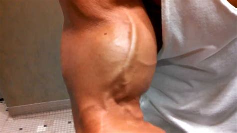 Arm pump is probably the most common injury in our sport, though as its causes are often. Flexing a Pumped Bicep - YouTube