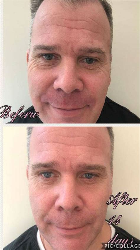 I did cleanse sometimes, i did tone sometimes, i always used a moisturiser, but i never really found one system. Trulum Review : Trulum Skincare Review Archives - Review ...
