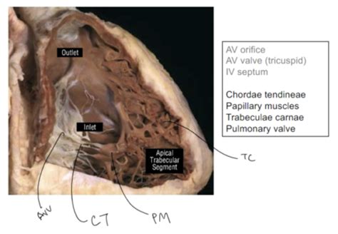 Venous blood from the heart is drained into right atrium by the following:a. BMS10-1020 - Thorax 3 - Heart | Flashcards