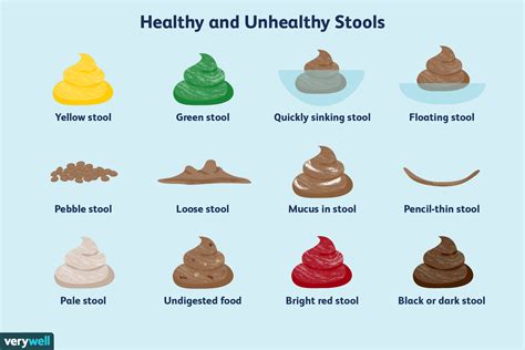 Advanced colon cancer is late stage 3 to stage 4 cancer of the colon or large intestine. Healthy and Unhealthy Stool: Poop Colors Explained