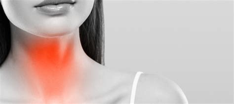 Utslettene kom ikke med en gang, men da blødningene i huden viste seg, ble diagnosen satt. Halsbetennelse: En komplett guide (Årsak, symptomer ...