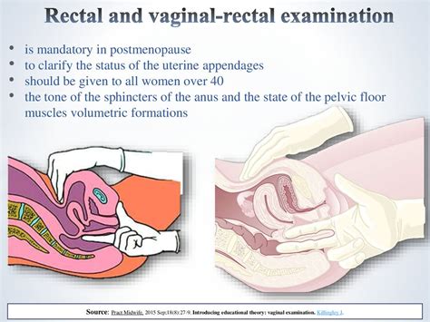 A digital rectal examination affords access to several key structures (see the image below) and enables an observant clinician to identify several disease processes pertaining to the rectum, the. Methods of examination in gynecology - online presentation