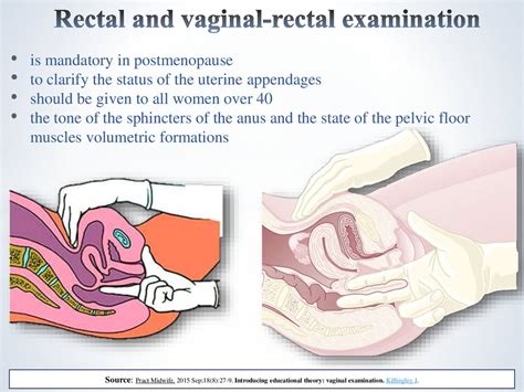 Traditional atls teaching was that a digital rectal exam (dre) is mandatory in trauma patients: Methods of examination in gynecology - online presentation