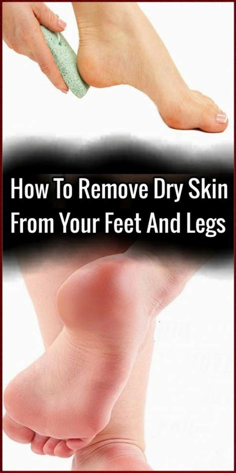 Please ensure that you are using baking soda and not baking powder for the following remedies to be effective. How To Remove Dry Skin From Your Feet And Legs - Skin Name ...