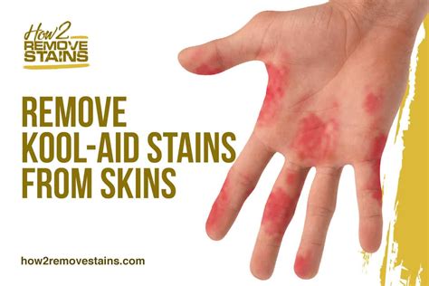 If you call stanley steemer they can tell you what's best to put on there to get rid of it. How to remove Kool-Aid stains from skin  Detailed Answer 