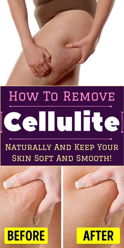 A cellulite cream shouldn't be too greasy and should absorb well into the skin. Pin on Best Cellulite Cream