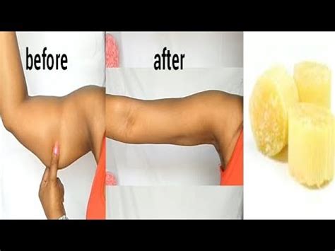 That is you should include a number of cardio sessions to your workout regimen. HOW TO LOSE ARM FAT FAST USE SUGAR-CANE GET RID OF FLABBY ...