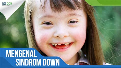 Untuk diagnosis pasti dari down syndrome, diperlukan pemeriksaan kromosom untuk menunjukkan kelainan trisomi 21. Ciri Ciri Bayi Yang Terkena Down Syndrome - Ini Cirinya