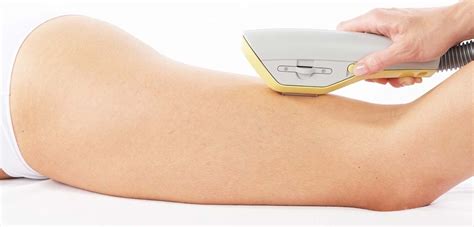 Ipl hair removal systems offer much more that hair removal. IPL Warrington | IPL Hair Removal | IPL Skin Rejuvenation