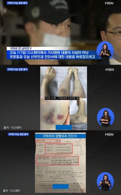 서울 아01558 / 등록일자 : '디스패치 폭로' 구하라 카톡, 지인 능욕 정황…"와서 무릎 ...