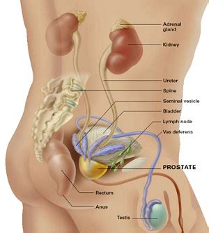 Less common symptoms can include finding blood in the urine or semen, or the sudden onset of erectile dysfunction. Your Health Online What is Prostate Cancer?