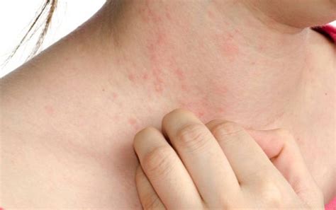 La description des symptômes permet généralement de poser un premier diagnostic. Comment faire face aux allergies
