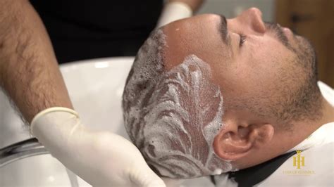 Which means you'll have to spend time and money to dye it again. How to wash your hair after hair transplant? - YouTube