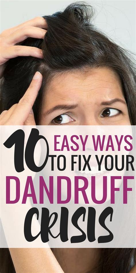 When to see your doctor the symptoms of eyebrow dandruff are just the same as we find in general symptoms of dandruff. 10 Easy Ways to Fix Your Dandruff Crisis | Hair dandruff ...
