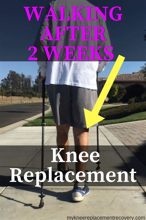 Move your cane forward at the same time as you step. Walking 2 Weeks After Knee Replacement Surgery | Knee ...
