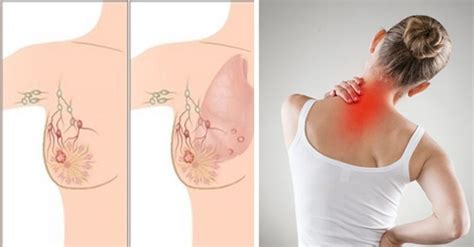 However, there can be other additional changes to the skin around and on the breast. Gauging the Breast Cancer Signs with Attention to Get the ...