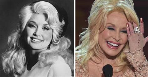 When Did Dolly Parton Get A Boob Job - Job Retro