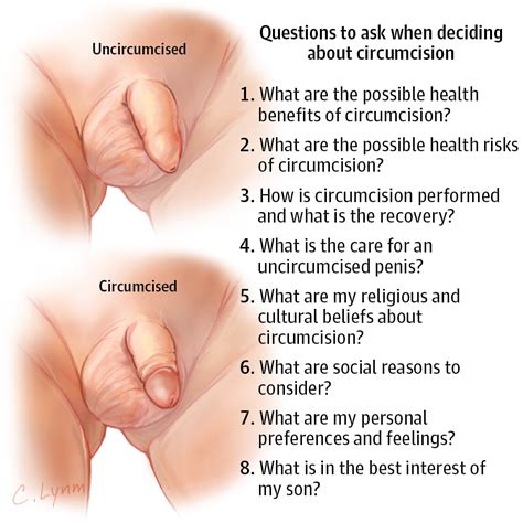 You might have heard that eating certain foods can change the smell of semen. Male Infant Circumcision | Infectious Diseases | JAMA ...