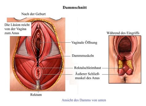 Die beamten müssen unbekannten nachstellen, die eine bronzefigur mit dem titel liebespaar beim geschlechtsakt von einer städtischen. Geschlechtsverkehr anatomie - handliniha