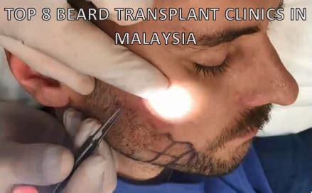 This technology provides the best and most effective hair transplant procedures and formulations of treatments, and caters to patients with varying. Top 8 Beard Transplant Clinics in Malaysia - Toppik Malaysia