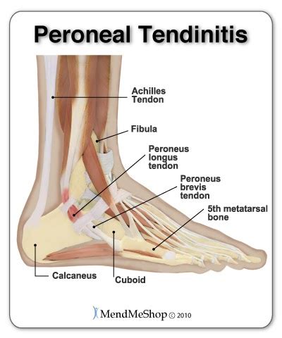 Left leg flexor tendon location. Left Leg Flexor Tendon Location : Flexor pollicis longus ...