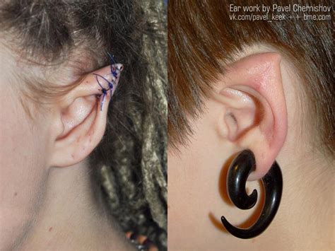 The elfish body modification involves reshaping the ear with surgery (image: Ear Pointing and Ultrablack Eyes | BME: Tattoo, Piercing ...