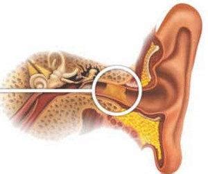 Crackling in the ears is not usually harmful if it only occurs once in a while. A crackling sound in the ear: the causes and treatment of ...