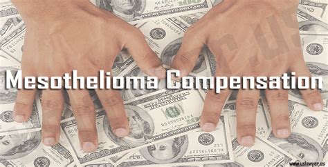 Mesothelioma settlements and verdicts provide compensation to mesothelioma patients and their families. Mesothelioma Settlement