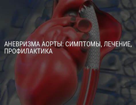 Диета при аневризме аорты брюшной Аневризма аорты: симптомы, причины виды, лечение, операция при Аневризма аорты: симптомы, причины виды, лечение, операция при Диета при аневризме аорты брюшной