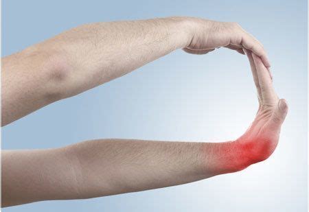 Tennis elbow, also known as lateral epicondylitis, is a condition in which the outer part of the elbow becomes painful and tender. 15 Physical Therapy Exercises For Tennis Elbows | healthy ...