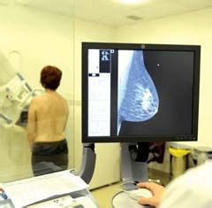 The assumption is that early detection will improve outcomes. Malta Breast Screening Programme - Women Fitness