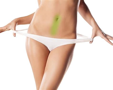 Do you want to take off. Laser Hair Removal Package, Belly Button | VS MedSpa Laser ...