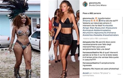 Nel 2017 ha partecipato a l'isola dei famosi, ma è apparso anche in. Rihanna si è fatta almeno tre interventi chirurgici ...