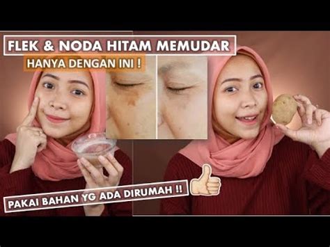 TIPS MENGHILANGKAN FLEK HITAM / NODA DI WAJAH DENGAN BAHAN ...