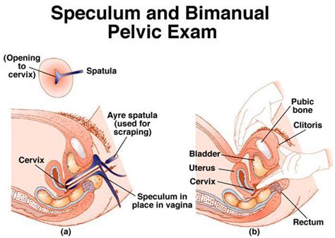 Check spelling or type a new query. The Important of a Pelvic Exam with Ultrasound